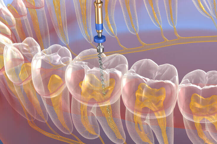 Endodontics